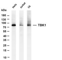 TBK1 (PT0490R) PT® Rabbit mAb