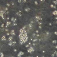 WM115 Cells人恶性黑色素瘤细胞传代培养|STR图谱