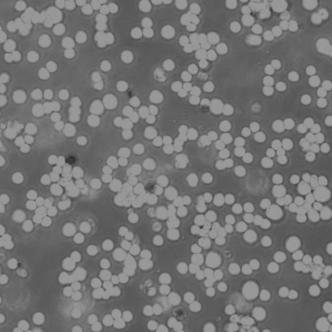 KYSE-140 Cells人食管鳞癌细胞传代培养|STR图谱