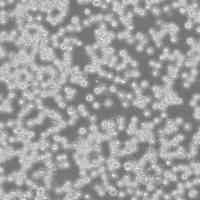 DoHH2 Cells人B细胞淋巴瘤细胞传代培养|STR图谱