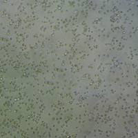 LAMA-84 Cells人多发性骨髓瘤细胞传代培养|STR图谱