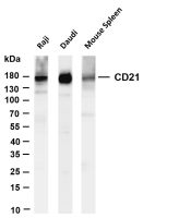 CD21 (PT0441R) PT® Rabbit mAb