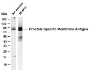 Prostate Specific Membrane Antigen (PSMA) (PT0482R) PT® Rabbit mAb