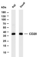 CD20 (PT0419R) PT® Rabbit mAb
