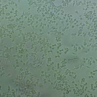 NCI-H2444 Cells人非小细胞肺癌细胞传代培养|STR图谱