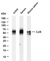 Lck (PT0416R) PT® Rabbit mAb