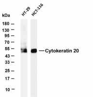 Cytokeratin 20 (PT0535R) PT® Rabbit mAb