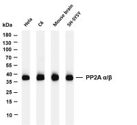 ATG3 (PT0538R) PT® Rabbit mAb