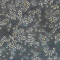 Lu-65 Cells人大细胞肺癌细胞传代培养|STR图谱