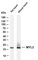 MelanA (PT0369R) PT® Rabbit mAb