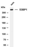 53BP1 (PT0456R) PT® Rabbit mAb