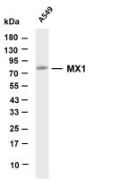 MX1 (PT0534R) PT® Rabbit mAb