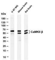 CaMKII β (PT0491R) PT® Rabbit mAb