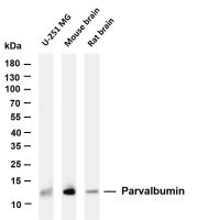 UBA52 (PT0081R) PT® Rabbit mAb