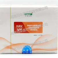 中检安泰 甲型肝炎病毒IgM抗体检测试剂盒(胶体金法)