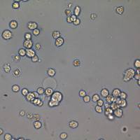 B-3 Cells人晶状体上皮细胞传代培养|STR图谱