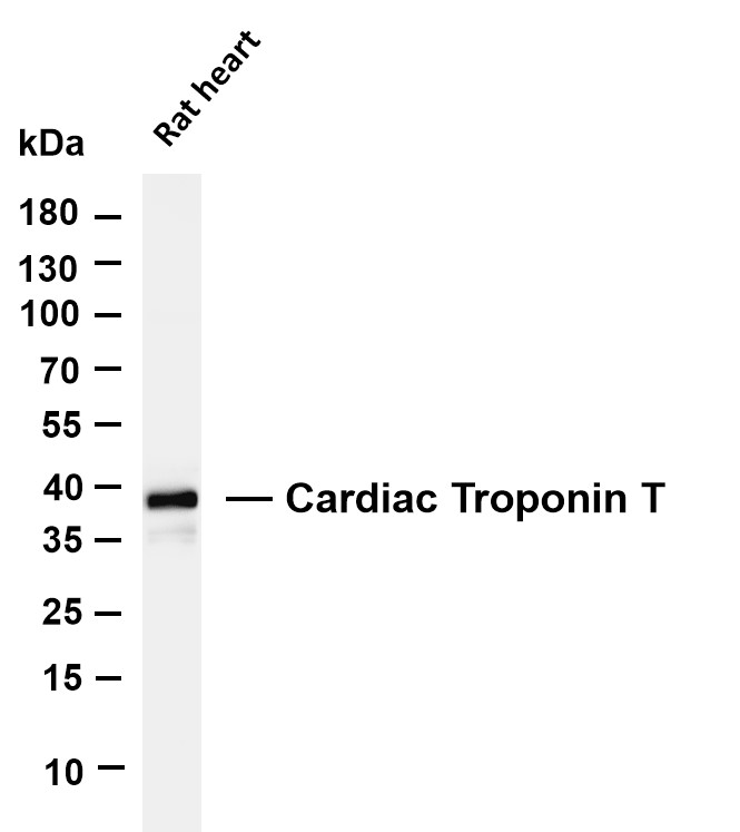 Cardiac Troponin T (PT0443R) PT® Rabbit mAb