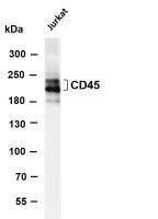 CD45 (PT0471R) PT® Rabbit mAb