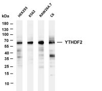 Paxillin (Phospho Tyr118) (PT0675R) PT® Rabbit mAb