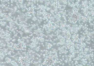 人肝星状细胞带绿色荧光LX-2+GFP