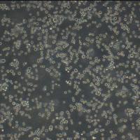 NCI-H1993 Cells人非小细胞肺癌腺癌细胞传代培养|STR图谱