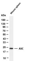 ASC (PT0530R) PT® Rabbit mAb