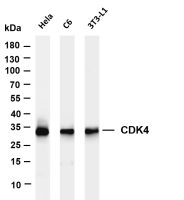 CDK4 (PT0399R) PT® Rabbit mAb
