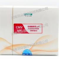 中检安泰 巨细胞病毒IgM抗体检测试剂盒(胶体金法)