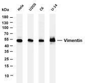 Vimentin (PT0495R) PT® Rabbit mAb