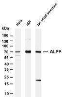 ALPP (PT0484R) PT® Rabbit mAb