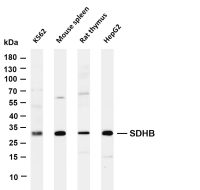 SDHB (PT0460R) PT® Rabbit mAb