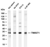 TWIST1 (PT0464R) PT® Rabbit mAb