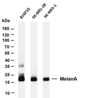 Myosin Light Chain 2 (PT0348R) PT® Rabbit mAb