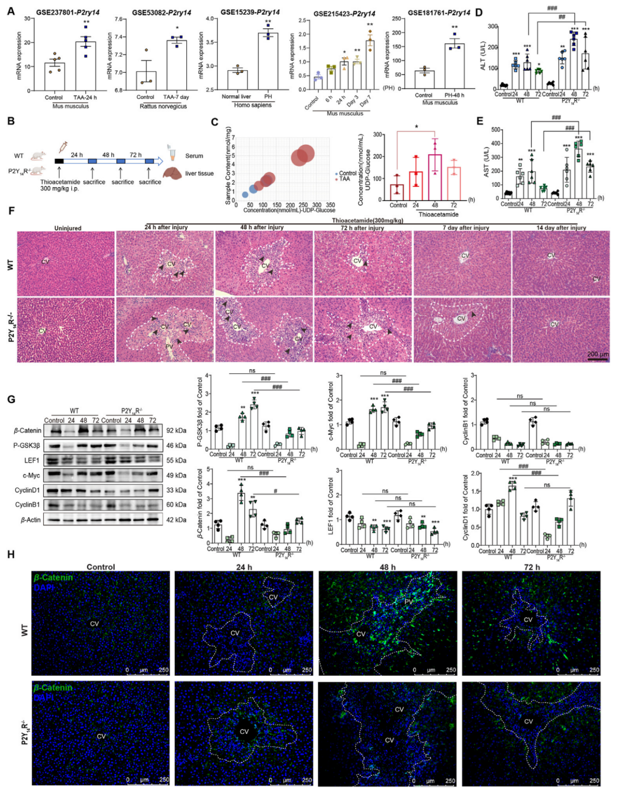 IF=14.7丨急性肝衰竭中肝脏再生的调控密码