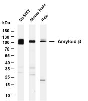 Amyloid-β (PT0488R) PT® Rabbit mAb