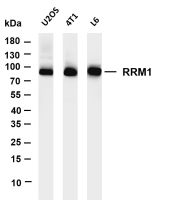 β Catenin (Phospho Ser675) (PT0838R) PT® Rabbit mAb