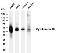 Cytokeratin 18 (PT0395R) PT® Rabbit mAb