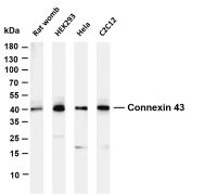 Connexin 43 (PT0467R) PT® Rabbit mAb
