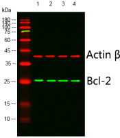 Bcl-2 (PT0487R) PT® Rabbit mAb
