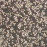 KHYG-1 Cells人自然杀伤细胞淋巴细胞白血病细胞传代培养|STR图谱