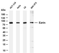 MMP9 (PT0731R) PT® Rabbit mAb
