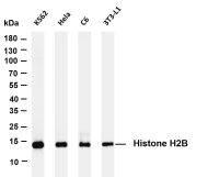 Histone H2B (PT0420R) PT® Rabbit mAb