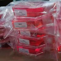 人套细胞淋巴瘤细胞Z-138