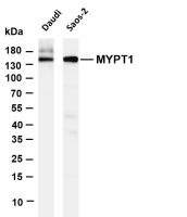 Raptor (PT0215R) PT® Rabbit mAb