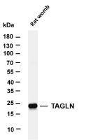 TAGLN (PT0469R) PT® Rabbit mAb