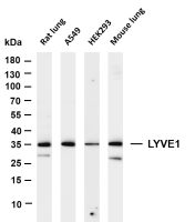 LYVE1 (PT0449R) PT® Rabbit mAb