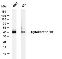 Cytokeratin 19 (PT0427R) PT® Rabbit mAb