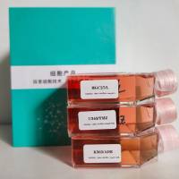 人宫颈癌细胞带红色荧光HELA+RFP