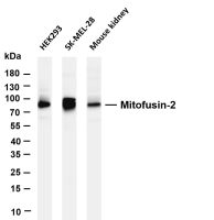 Mitofusin-2 (PT0529R) PT® Rabbit mAb