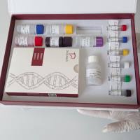 Influenza Virus A甲型流感(禽流感)病毒H3N8亚型染料法荧光定量RT-PCR试剂盒